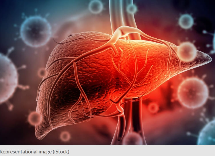 놀라운 백년 수명의 &#39;간&#39; Transplanted livers can keep going for a total of more than 100 years&#44; according to new research