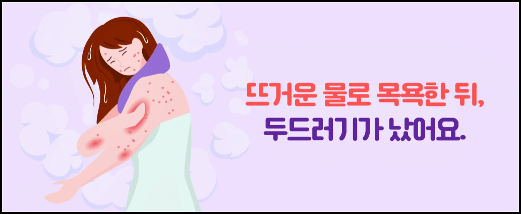  콜린성 두드러기 증상 원인 치료 등 총정리