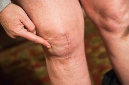 무릎 앞쪽 통증 회복 운동 루틴