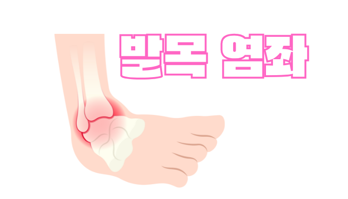 발목 염좌 병원 방문