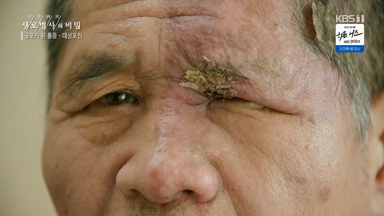 생로병사의 비밀.E857.230223p.H264-F1RST.mp4_20230223_202243.084.jpg