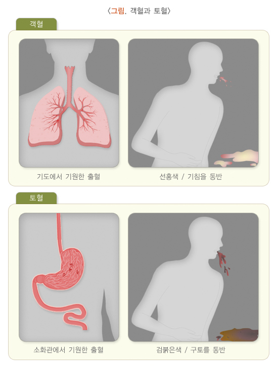  객혈
