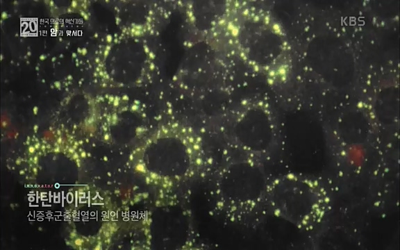 [806회] 생로병사의 비밀 - KBS806회] 생로병사의 비밀.ts_20220815_181043.165.jpg