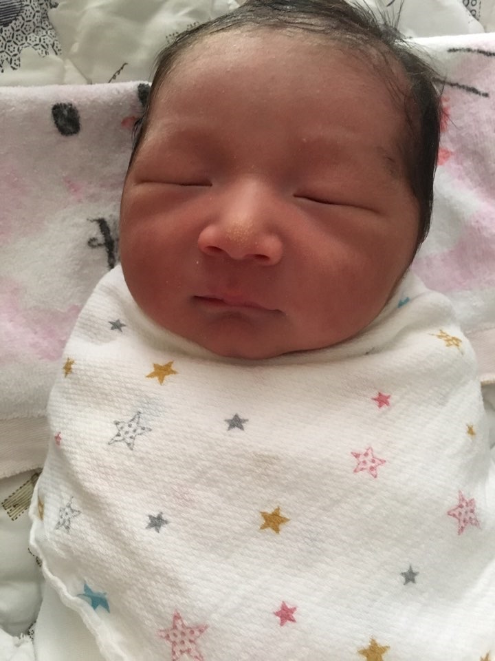 치료 너무 걱정하지 마세요 신생아 황달 원인과 수치, 10