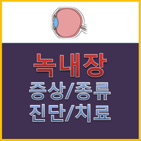  녹내장 증상 자세히 살펴보기