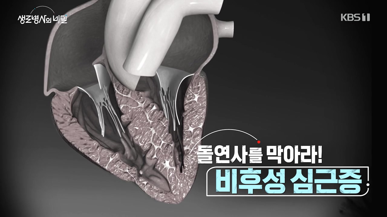 생로병사의 비밀.E912.240523p-NEXT.mp4_20240523_195848.154.jpg