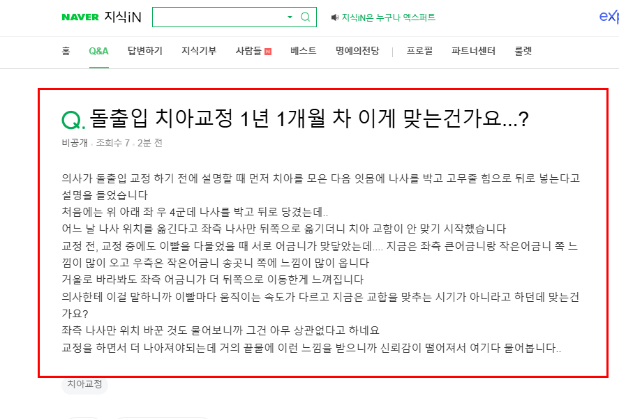 치아교정 과정 막바지 질문