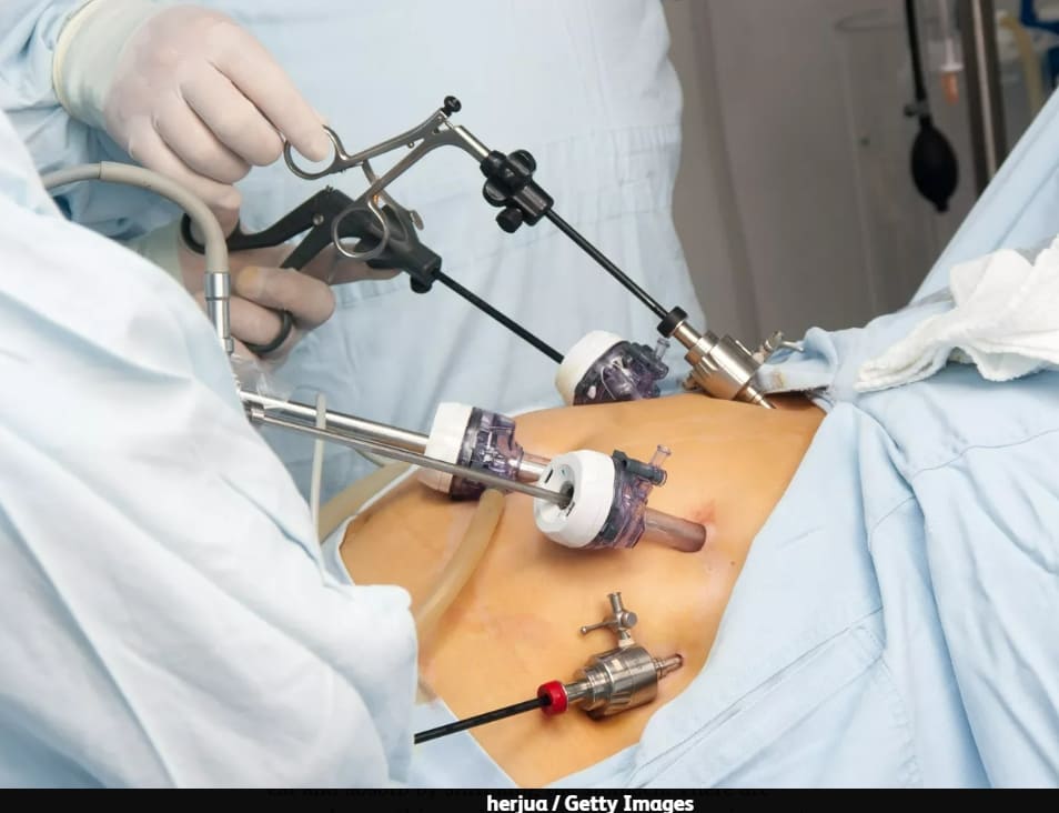 이 수술' 받았더니 암 위험 감소  ㅣ 비만과  중피질 연결 연구: 식욕 Bariatric surgery linked to lower cancer risk in women ㅣ New Study Shows Changed Mesocortical Connectivity in Obesity