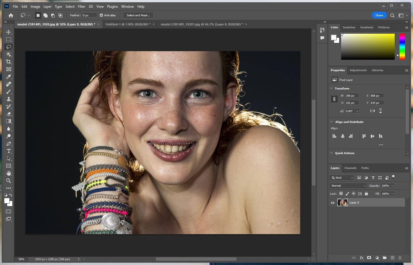 미백효과 적용할 치아 선택