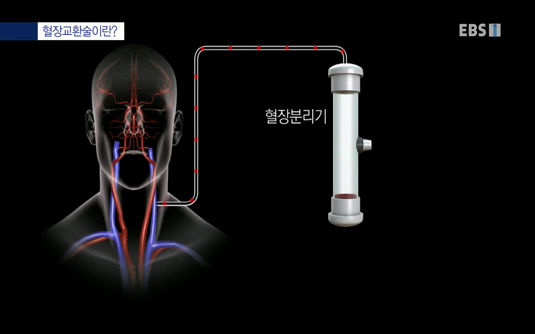 EBS 명의 헬스케어 - TV - 교육의 중심 EBS명의 15년 - 간, 완치에 도전하다.mp4_20220802_202422.994.jpg