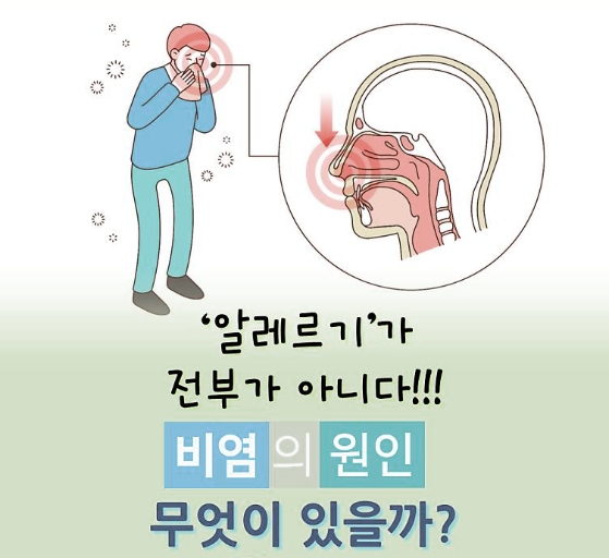 비염의 원인, 증상, 치료 방법
