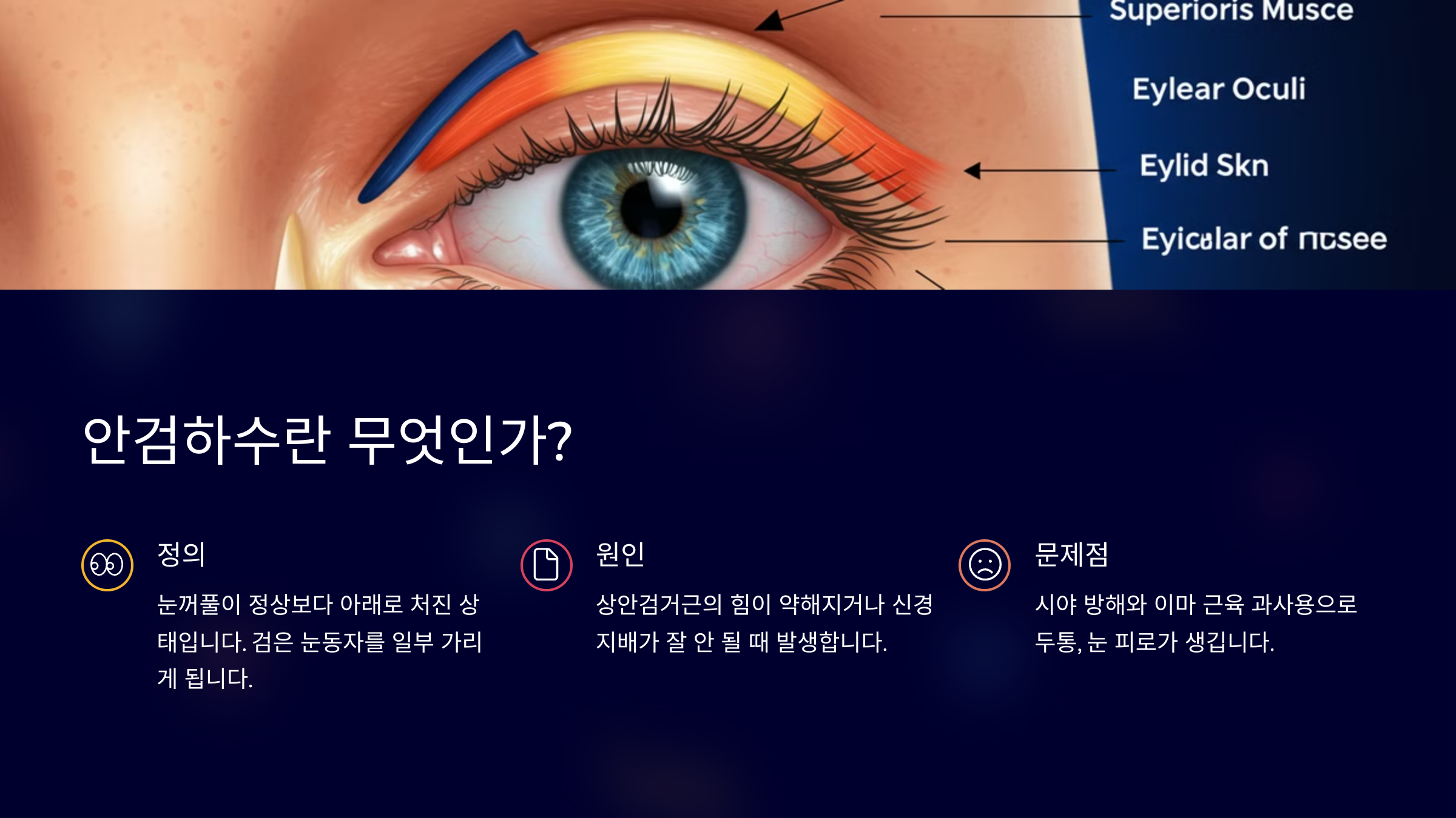안검하수란 무엇인가요?
