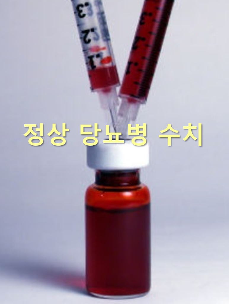  당뇨병 치료법과 정상 당뇨병 수치