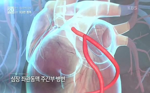 [807회] 생로병사의 비밀 - KBS807회] 생로병사의 비밀.ts_20220818_213101.765.jpg