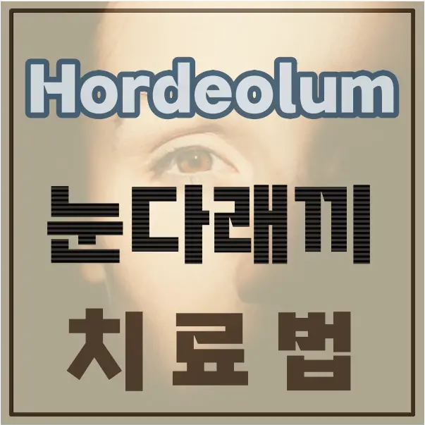 눈다래끼 치료법