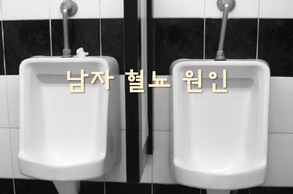  남자 혈뇨 원인과 혈뇨가 나오는 이유