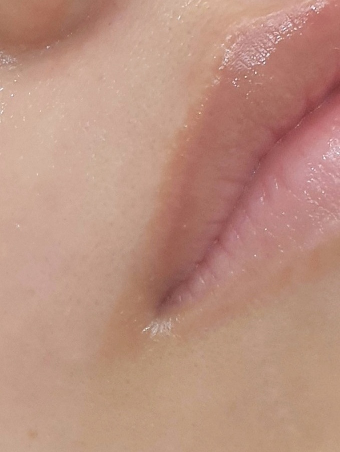 로제네일 이미지
