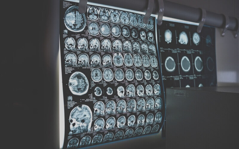 CT-검사
