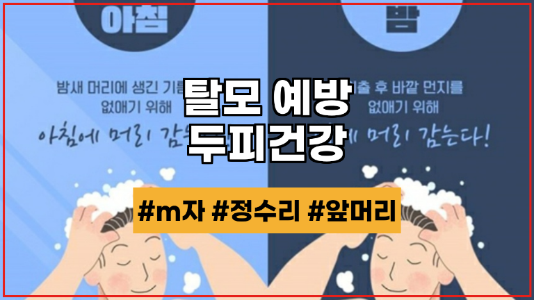  m자, 정수리, 앞머리 탈모 예방법