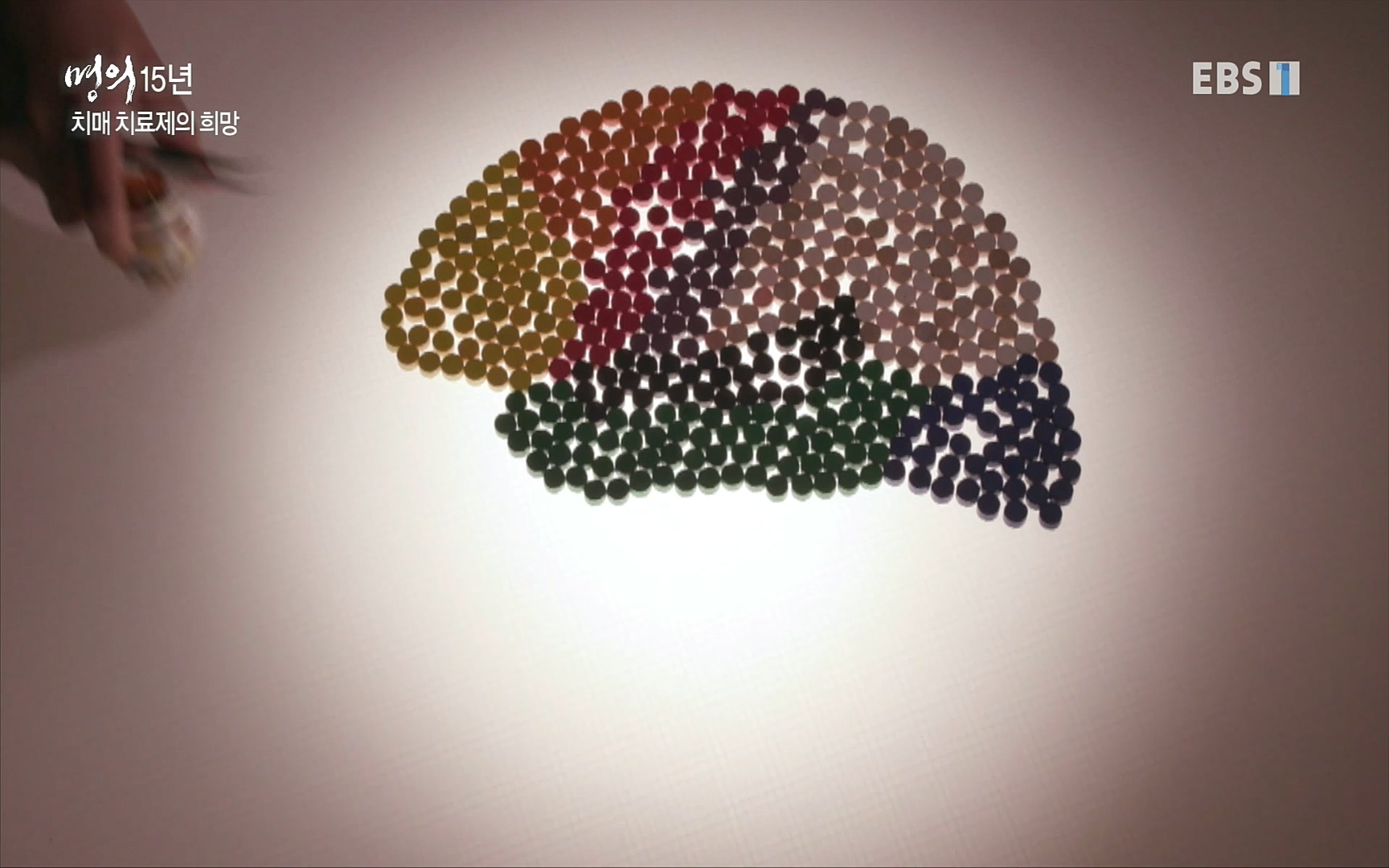 EBS 명의 헬스케어 - TV - 교육의 중심 EBS명의 15년 치매 치료의 패러다임이 바뀐다.mp4_20220808_211018.821.jpg