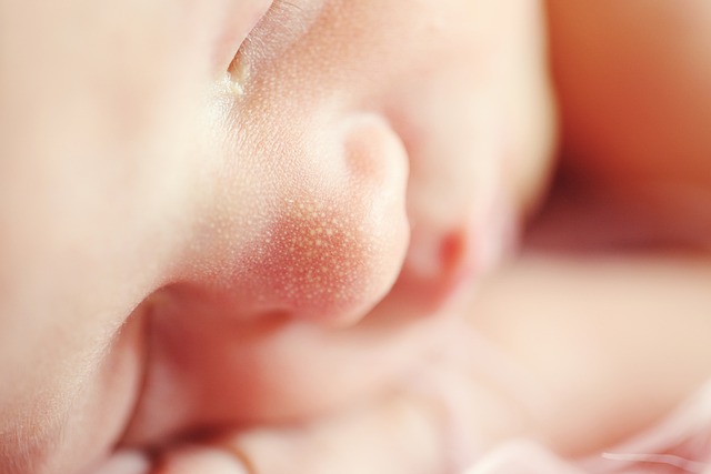 영유아 수족구병 전염치료예방