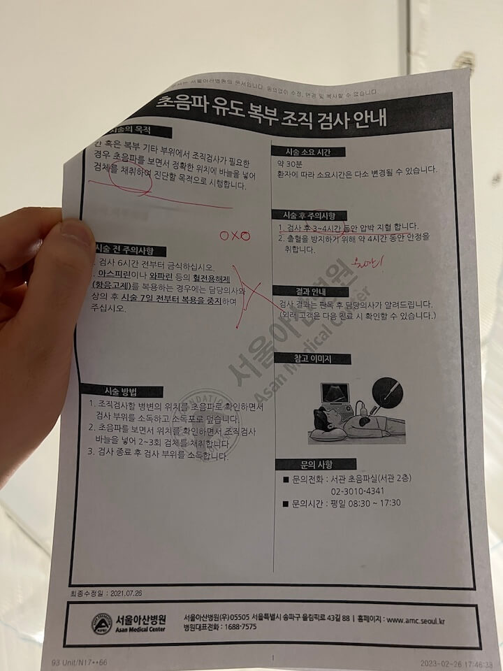 아산병원-간조직검사-후기