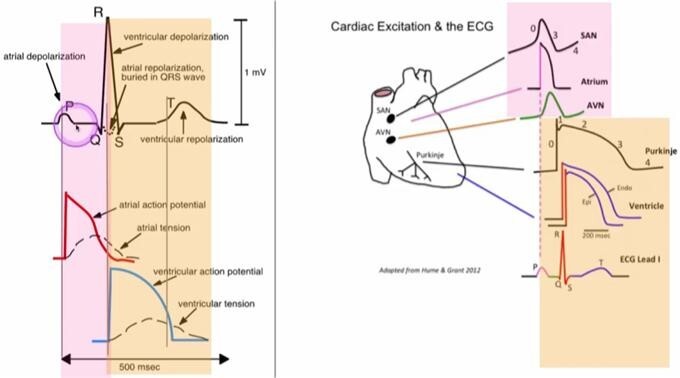 pacemaker cell과 ventricle cell의 cardiac action-potential 사진