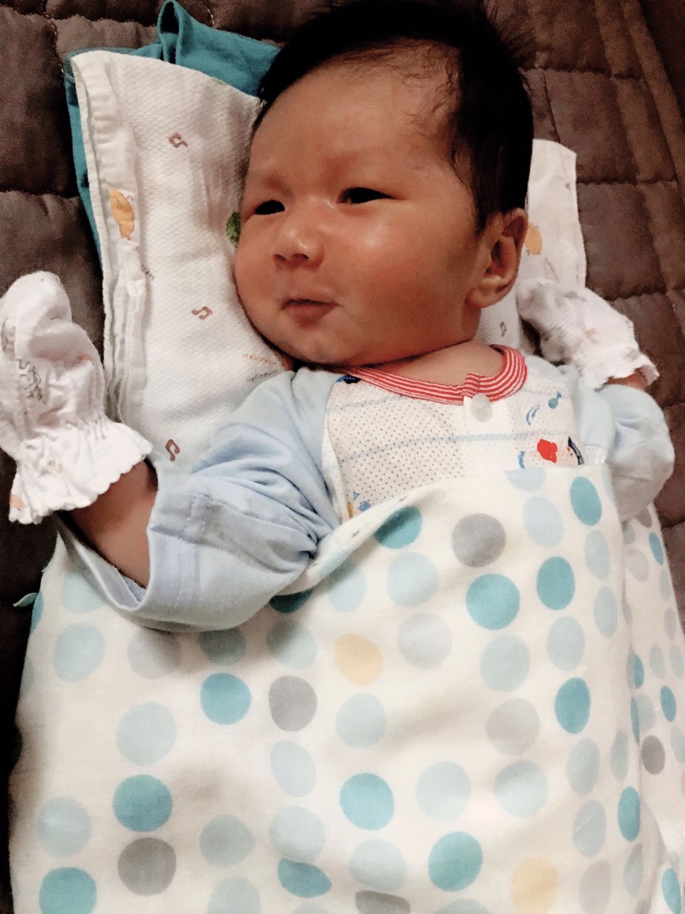 치료 너무 걱정하지 마세요 신생아 황달 원인과 수치, 13