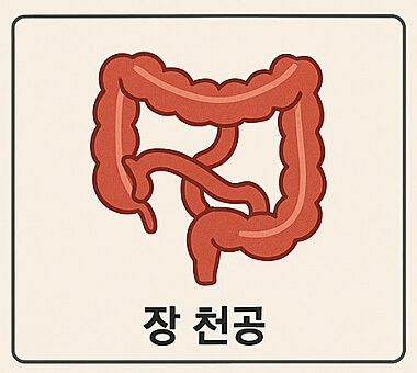 장천공