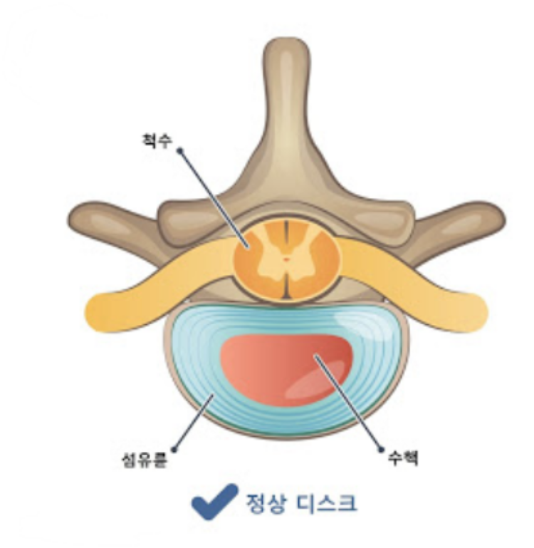 사진설명