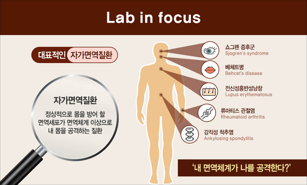 자가면역질환