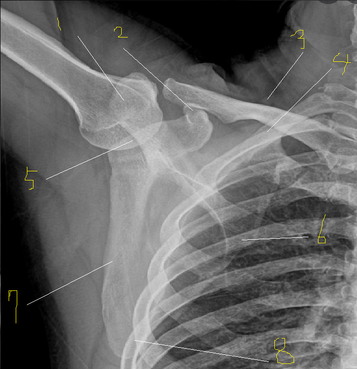 Scapula AP,LAT