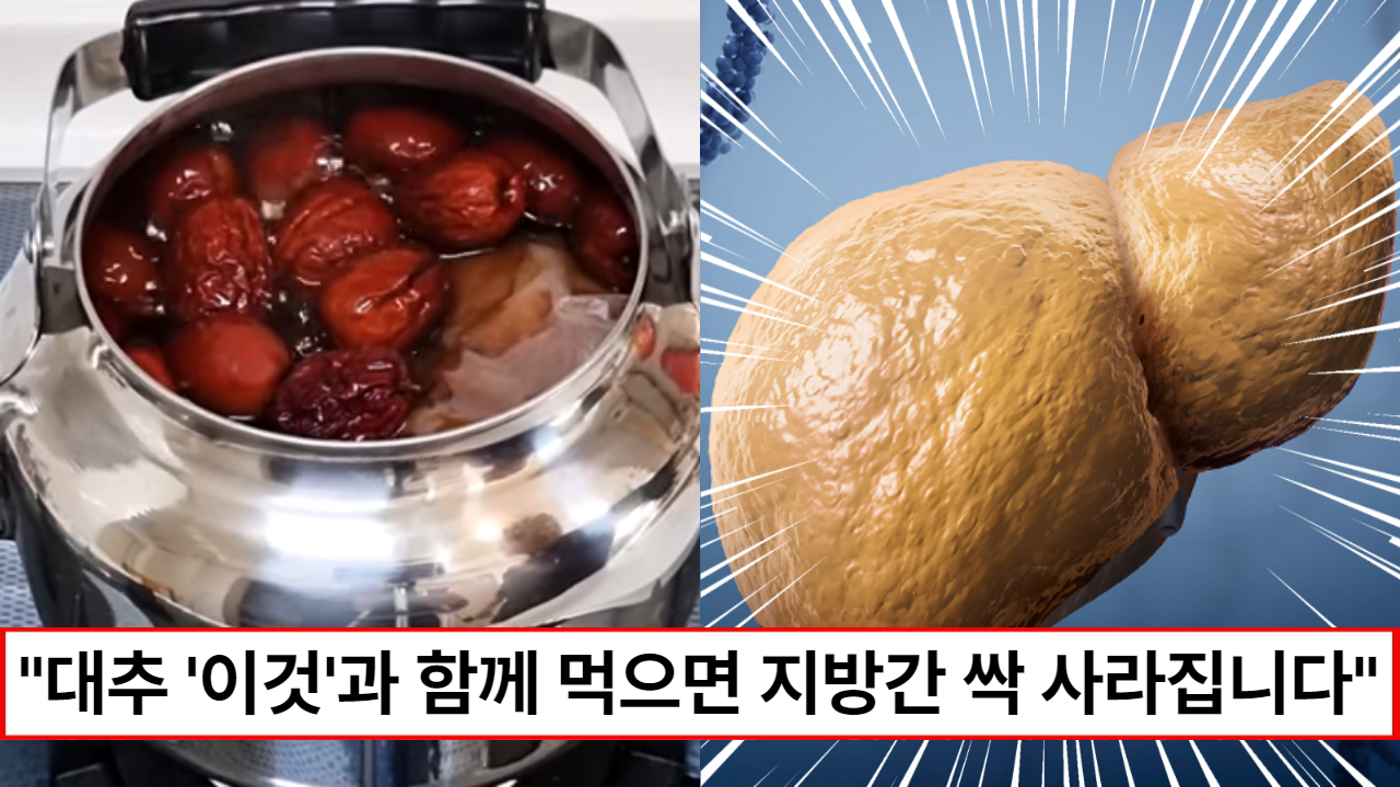 “술 좋아하는 사람한테 진짜 좋습니다” 간에 쌓인 지방을 없애주고 간경화나 간암을 예방해 준다는 대추 양파차 레시피 1가지