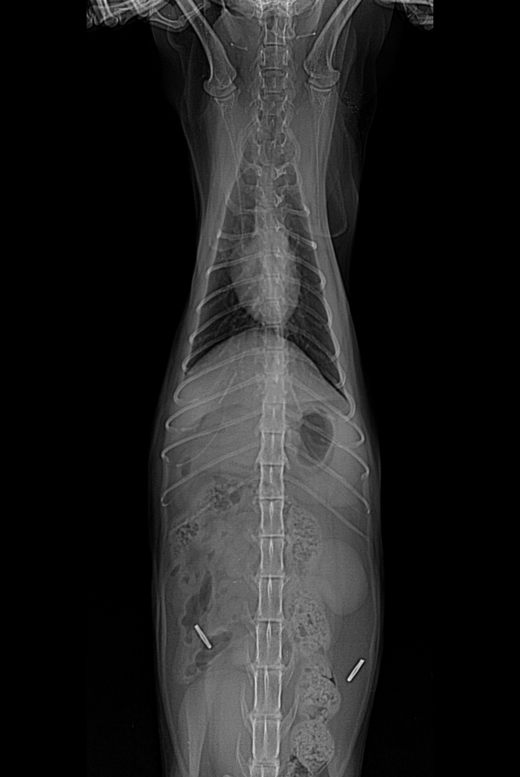 쌤 X-ray