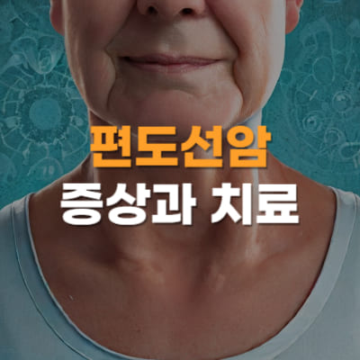 편도선암 증상&#44; 편도선암&#44; 편도선암치료&#44; 원인
