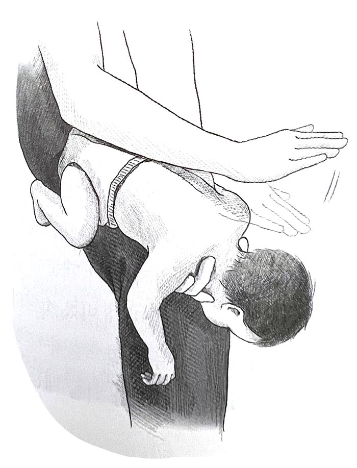 아기응급조치
이물질삼켰을때