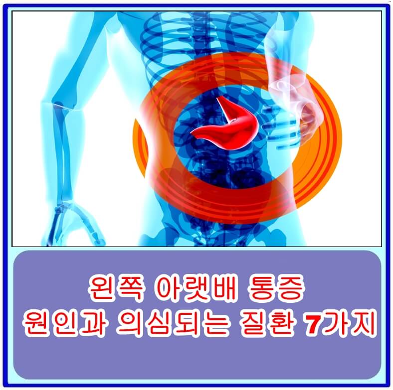 왼쪽 아랫배 통증의 원인과 의심되는 질환 7가지 치료방법