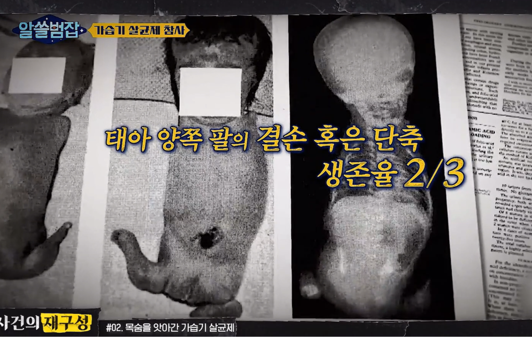  미국 FDA신뢰성_FDA_의학 최악의 사고_임산부 입덧치료제_기형아 출산_사지가없는 기형아 출산_알쓸범잡