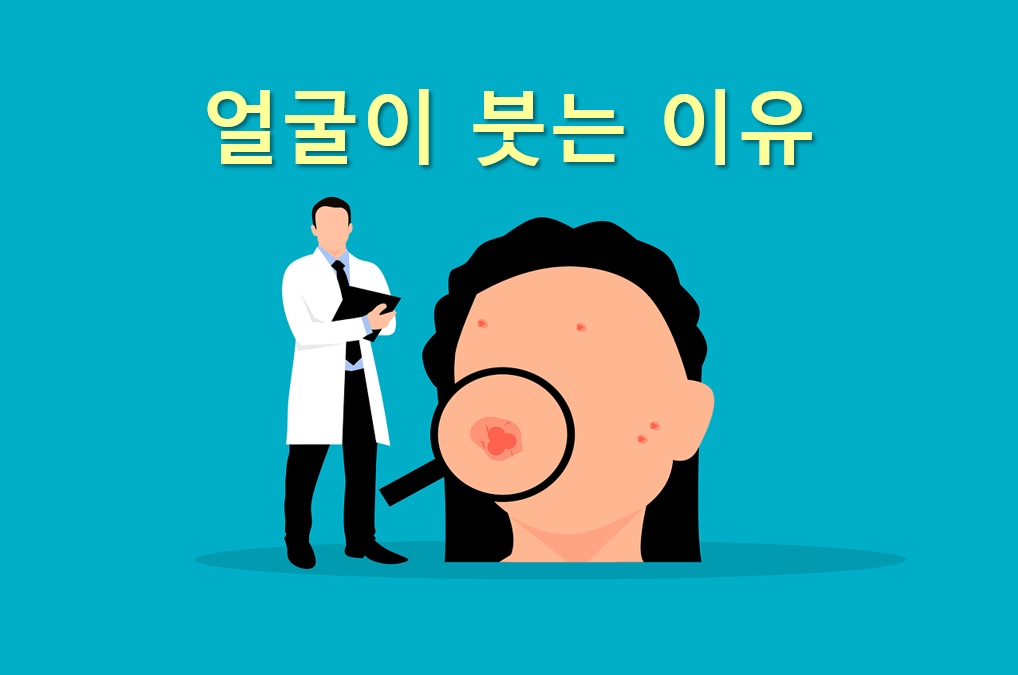 얼굴이 붓는 이유와 얼굴이 가려운 이유