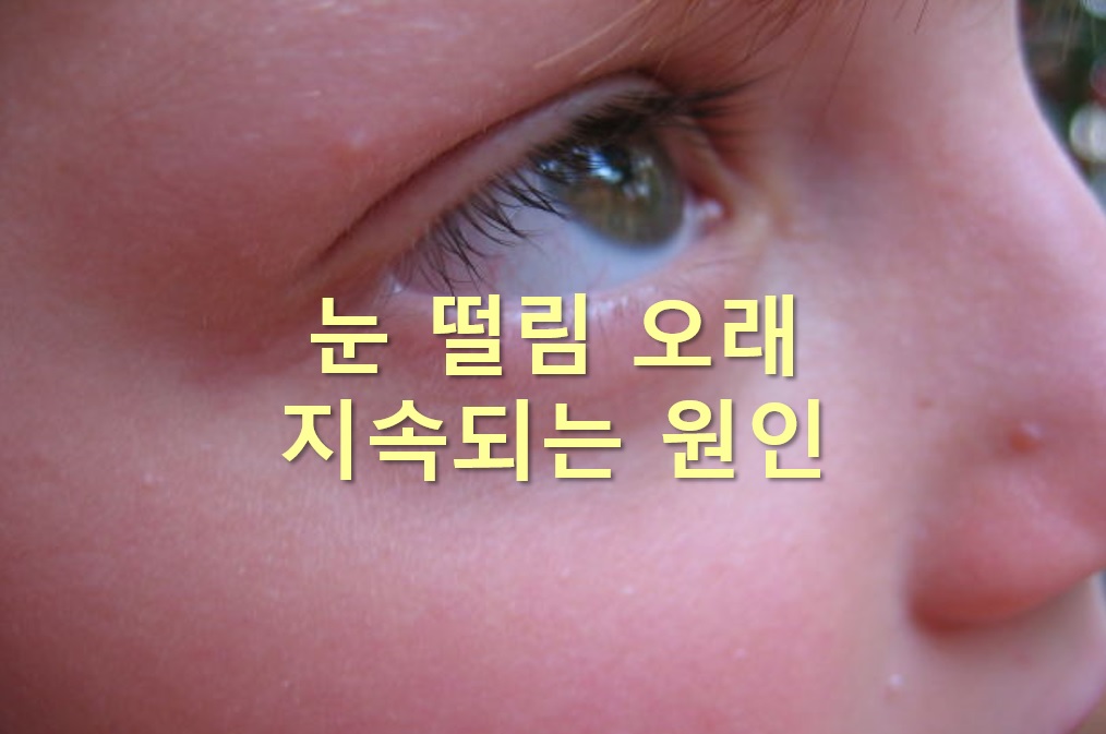  눈 떨림 오래 지속되는 원인과 눈 떨림에 좋은 음식