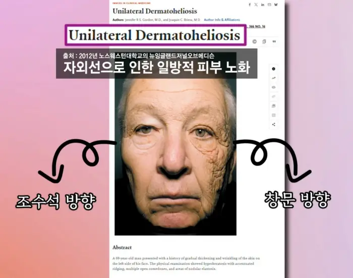 선크림을-발라야-하는-이유