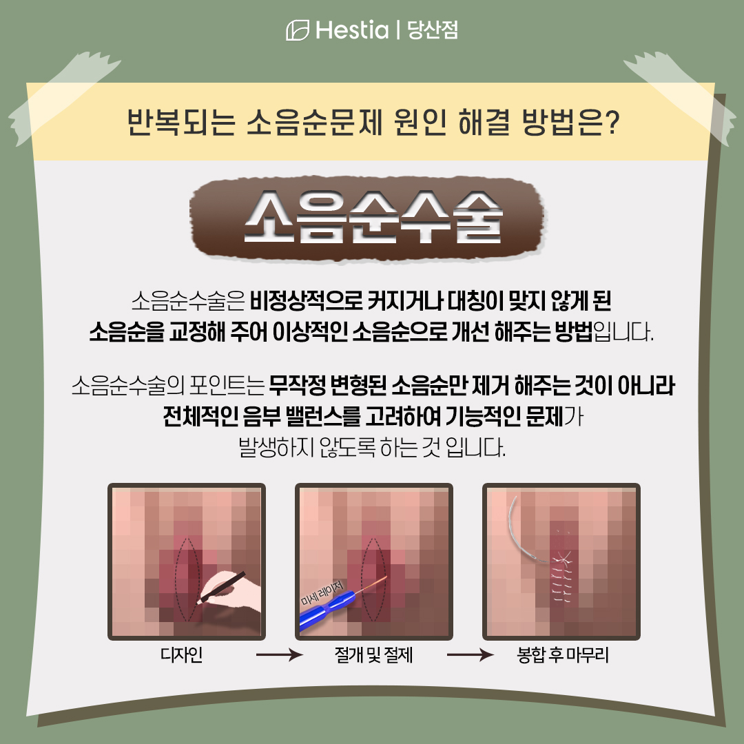 반복되는 소음순 뾰루지 원인 해결 방법은?