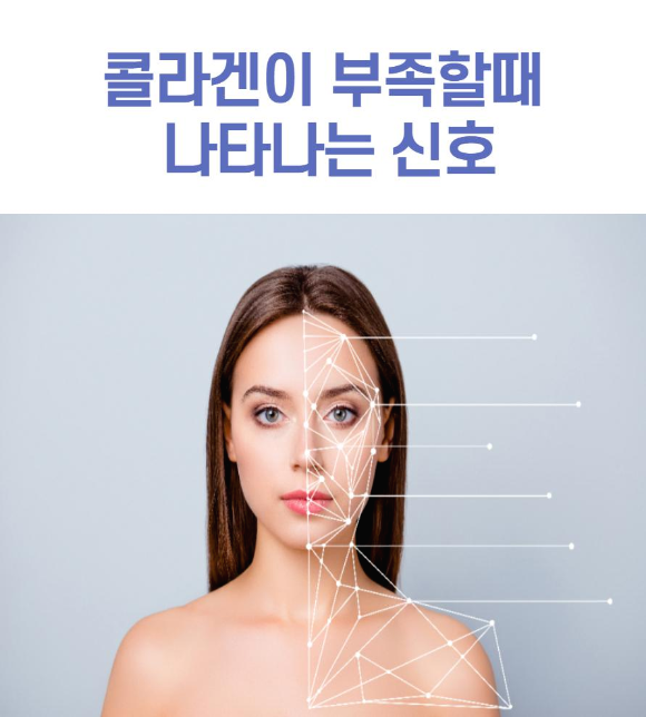  콜라겐이 부족할떄 나타나는 신호