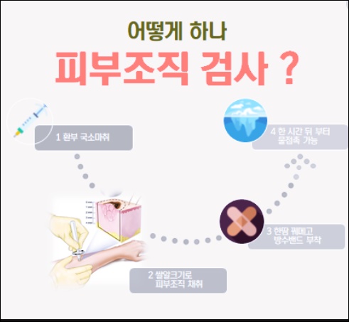 병리 조직검사 피부 조직검사 방법, 부작용 4