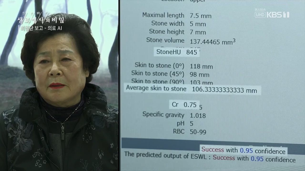 생로병사의 비밀.E869.230518p.H264-F1RST.mp4_20230518_200712.437.jpg