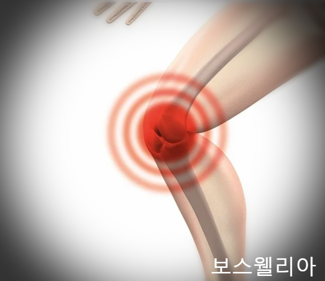  관절과 연골 건강을 생각하신다면 프롬바이오보스웰리아가 딱이에요 보스웰리아 효능도 알아봐요