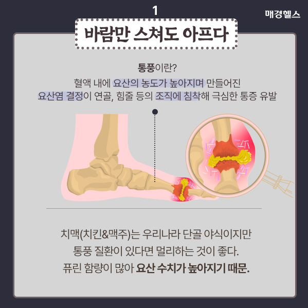 통풍 증상이란? 통풍이 생기는 원인과 좋은 음식