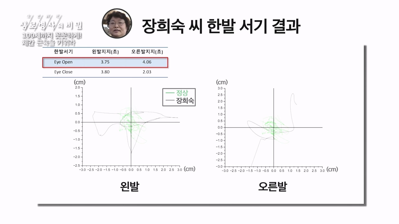 생로병사의 비밀.E885.231012p-NEXT.mp4_20231012_203449.216.jpg