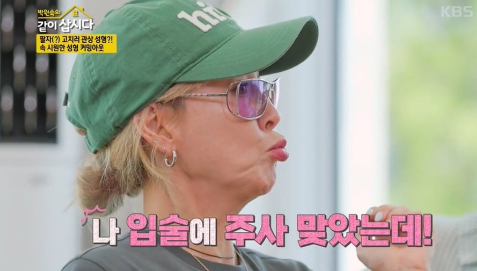 이상아 성형고백