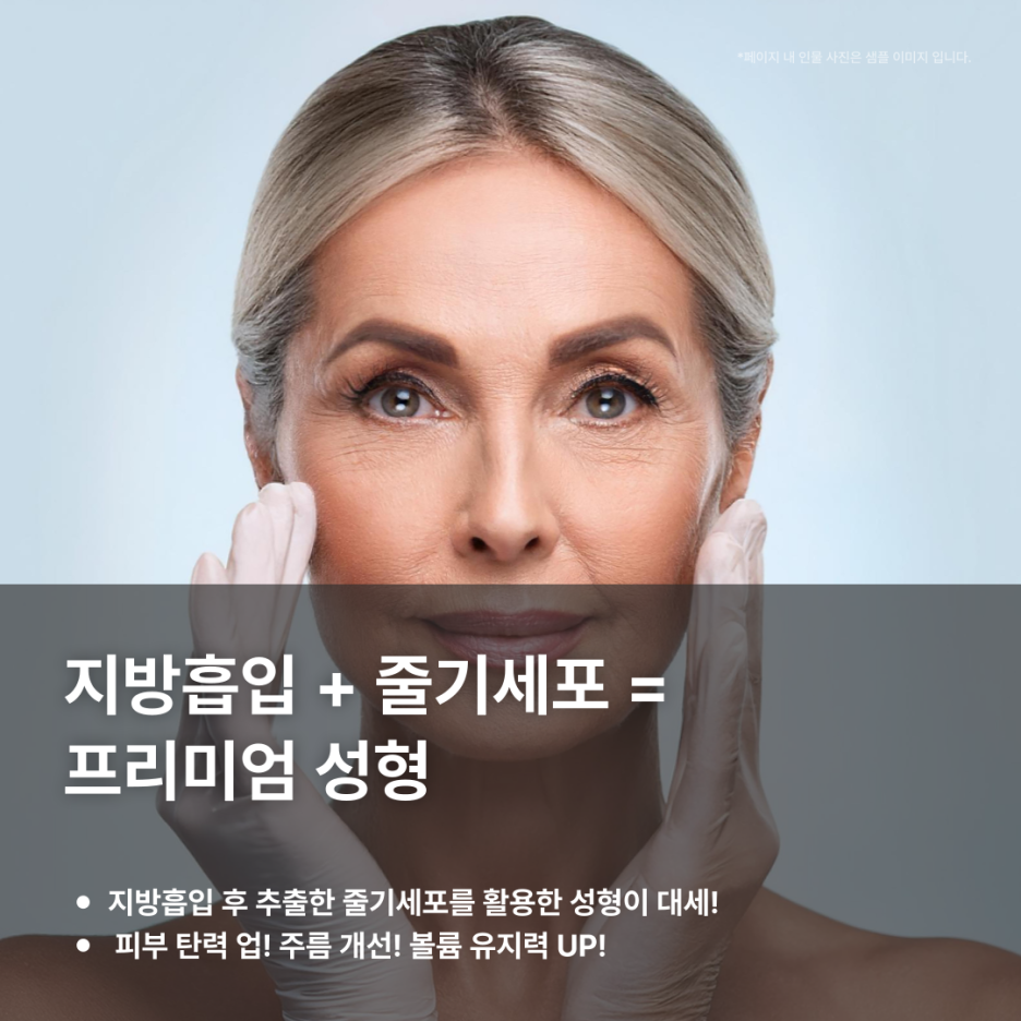 img 지방흡입 후 버려지는 지방, 알고 보니 줄기세포 보물 창고?!